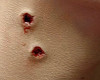 vampire bite marks