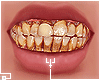 †. M Teeth 171