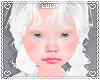 Kid ☆ Kiky Albino