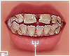 †. M Teeth 166