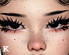 Subtle Freckles