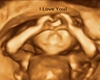 Love HH Ultrasound