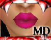 MD Pink Passion LipGloss