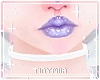 ♡ Care Chocker ♡