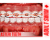 f. Asteri Teeth 46