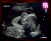 4M Ultrasound Frame {MS}
