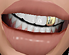 A| Gold Tooth