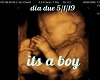 Dia ultrasound its boy