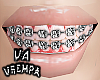 va. braces F