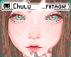 🐙 Chu freckles MH