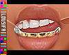 †. MH Teeth 13