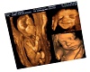 3d Ultrasound Smiling