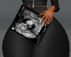 Preg 4 Ultrasound