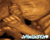 JvYmUn3YJr Sonogram