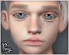 Albino Andro Head