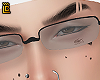 Oculos descanso LCST