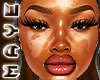 M. VITILIGO MH V2 HD