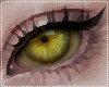 Y. Anisocoria eyes