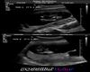 BOSSilini Ultrasound