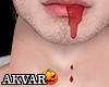 ᴀ| Mouth bleeding