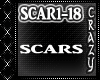 Scars