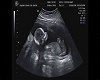 XRAY