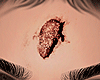 ◈ Wound