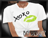 [BGD]X0X0 Kiss Top 2