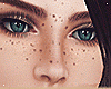 Face Freckles