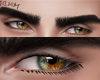 Eyes Heterochromia