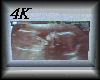 4K Baby Scan Photo Blue