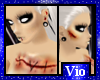 VIO Bloody Wounded Skin3
