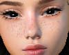 Dev. freckle