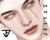 ♛Xiaolan Scar MH