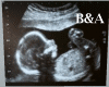 [BA] Baby Ultrasound