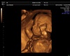 Missy's 4 mo. Ultrasound