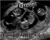 Triplets Ultrasound Pic