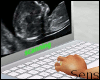  4D baby scan