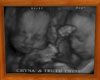 MRS &MR TRUTH ultrasound