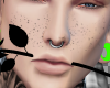 Freckles