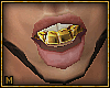 Gold Teeth