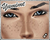 [Y] Add-on Freckles