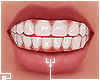  . M Teeth 167