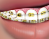 Brace Face