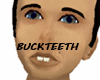 Buckteeth