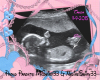 Swirv Baby Girl Sonogram