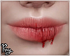 Bloodied Lips