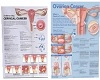 ovarian/cervical poster