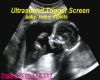 Ultrasound Trigger TV