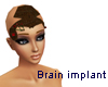 Brain Implant